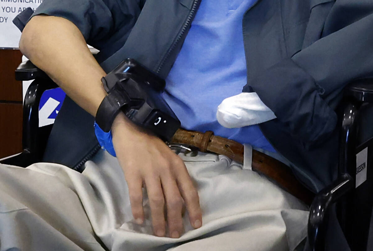 Las Vegas Amputee Sparks Debate Over Ankle Monitor Policy and Disability Accommodation